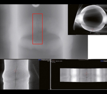 Vorteile gegenüber Röntgentechnik: Zerstörungsfreies Nachweisen von Ungänzen in Schweißnähten durch
Computertomographie